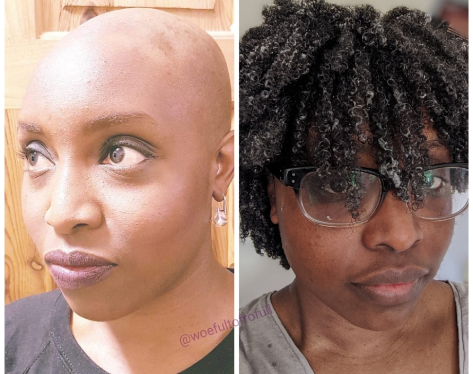 hair growth comparison